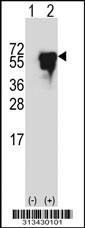 Western blot analysis of his-tag ETS2 (arrow) using his tag antibody. 293 cell lysates (2 ug/lane) either nontransfected (Lane 1) or transiently transfected with the gene