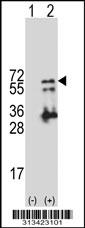 Western blot analysis of his-tag SQRDL (arrow) using his tag antibody. 293 cell lysates (2 ug/lane) either nontransfected (Lane 1) or transiently transfected with the gene