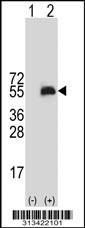 Western blot analysis of his-tag FBXO5 (arrow) using his tag antibody. 293 cell lysates (2 ug/lane) either nontransfected (Lane 1) or transiently transfected with the gene