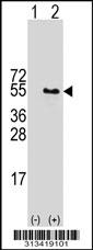 Western blot analysis of his-tag TADA2L (arrow) using his tag antibody. 293 cell lysates (2 ug/lane) either nontransfected (Lane 1) or transiently transfected with the gene