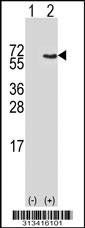 Western blot analysis of his-tag PSMC1 (arrow) using his tag antibody. 293 cell lysates (2 ug/lane) either nontransfected (Lane 1) or transiently transfected with the gene