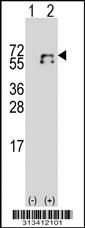 Western blot analysis of his-tag LCAT (arrow) using his tag antibody. 293 cell lysates (2 ug/lane) either nontransfected (Lane 1) or transiently transfected with the gene