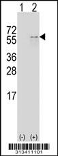 Western blot analysis of his-tag C1orf103 (arrow) using his tag antibody. 293 cell lysates (2 ug/lane) either nontransfected (Lane 1) or transiently transfected with the gene
