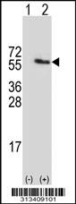 Western blot analysis of his-tag CCDC47 (arrow) using his tag antibody. 293 cell lysates (2 ug/lane) either nontransfected (Lane 1) or transiently transfected with the gene