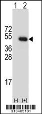 Western blot analysis of his-tag TRIM21 (arrow) using his tag antibody. 293 cell lysates (2 ug/lane) either nontransfected (Lane 1) or transiently transfected with the gene