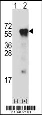 Western blot analysis of his-tag PROC (arrow) using his tag antibody. 293 cell lysates (2 ug/lane) either nontransfected (Lane 1) or transiently transfected with the gene
