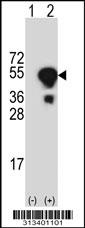 Western blot analysis of his-tag SMCR7L (arrow) using his tag antibody. 293 cell lysates (2 ug/lane) either nontransfected (Lane 1) or transiently transfected with the gene