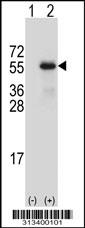 Western blot analysis of his-tag PDLIM7 (arrow) using his tag antibody. 293 cell lysates (2 ug/lane) either nontransfected (Lane 1) or transiently transfected with the gene