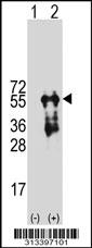 Western blot analysis of his-tag TUBG2 (arrow) using his tag antibody. 293 cell lysates (2 ug/lane) either nontransfected (Lane 1) or transiently transfected with the gene