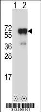 Western blot analysis of his-tag TUBA4A (arrow) using his tag antibody. 293 cell lysates (2 ug/lane) either nontransfected (Lane 1) or transiently transfected with the gene