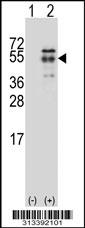 Western blot analysis of his-tag SYT11 (arrow) using his tag antibody. 293 cell lysates (2 ug/lane) either nontransfected (Lane 1) or transiently transfected with the gene