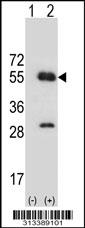 Western blot analysis of his-tag IL11RA (arrow) using his tag antibody. 293 cell lysates (2 ug/lane) either nontransfected (Lane 1) or transiently transfected with the gene