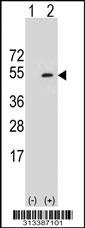 Western blot analysis of his-tag EIF4A3 (arrow) using his tag antibody. 293 cell lysates (2 ug/lane) either nontransfected (Lane 1) or transiently transfected with the gene