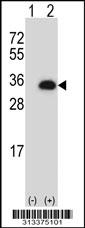 Western blot analysis of his-tag RPS2 (arrow) using his tag antibody. 293 cell lysates (2 ug/lane) either nontransfected (Lane 1) or transiently transfected with the gene