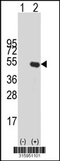 Western blot analysis of his-tag GDA (arrow) using his tag antibody. 293T cell lysates (2 ug/lane) either nontransfected (Lane 1) or transiently transfected with the GDA gene‘