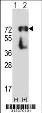 Western blot analysis of his-tag SDPR (arrow) using his tag antibody. 293 cell lysates (2 ug/lane) either nontransfected (Lane 1) or transiently transfected with the gene