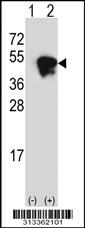 Western blot analysis of his-tag RBM15B (arrow) using his tag antibody. 293 cell lysates (2 ug/lane) either nontransfected (Lane 1) or transiently transfected with the gene