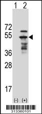 Western blot analysis of his-tag RENBP (arrow) using his tag antibody. 293 cell lysates (2 ug/lane) either nontransfected (Lane 1) or transiently transfected with the gene