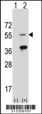 Western blot analysis of his-tag BRF2 (arrow) using his tag antibody. 293 cell lysates (2 ug/lane) either nontransfected (Lane 1) or transiently transfected with the gene