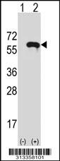 Western blot analysis of his-tag TUBA3C (arrow) using his tag antibody. 293 cell lysates (2 ug/lane) either nontransfected (Lane 1) or transiently transfected with the gene