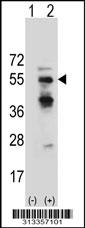 Western blot analysis of his-tag MKRN2 (arrow) using his tag antibody. 293 cell lysates (2 ug/lane) either nontransfected (Lane 1) or transiently transfected with the gene