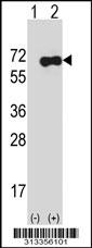 Western blot analysis of his-tag NKAP (arrow) using his tag antibody. 293 cell lysates (2 ug/lane) either nontransfected (Lane 1) or transiently transfected with the gene