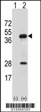 Western blot analysis of his-tag ACAD8 (arrow) using his tag antibody. 293 cell lysates (2 ug/lane) either nontransfected (Lane 1) or transiently transfected with the gene