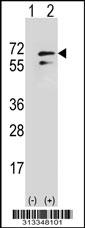 Western blot analysis of his-tag RAD23B (arrow) using his tag antibody. 293 cell lysates (2 ug/lane) either nontransfected (Lane 1) or transiently transfected with the gene