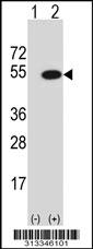 Western blot analysis of his-tag NARF (arrow) using his tag antibody. 293 cell lysates (2 ug/lane) either nontransfected (Lane 1) or transiently transfected with the gene