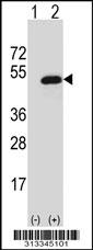 Western blot analysis of his-tag C1orf94 (arrow) using his tag antibody. 293 cell lysates (2 ug/lane) either nontransfected (Lane 1) or transiently transfected with the gene