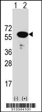 Western blot analysis of his-tag OLFML3 (arrow) using his tag antibody. 293 cell lysates (2 ug/lane) either nontransfected (Lane 1) or transiently transfected with the gene