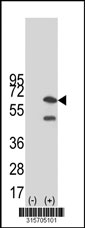 Western blot analysis of his-tag TRMT6 (arrow) using his tag antibody. 293T cell lysates (2 ug/lane) either nontransfected (Lane 1) or transiently transfected with the TRMT6 gene‘