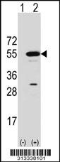 Western blot analysis of his-tag PLEKHA1 (arrow) using his tag antibody. 293 cell lysates (2 ug/lane) either nontransfected (Lane 1) or transiently transfected with the gene