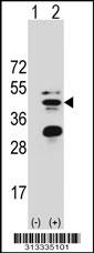 Western blot analysis of his-tag SIRT3 (arrow) using his tag antibody. 293 cell lysates (2 ug/lane) either nontransfected (Lane 1) or transiently transfected with the gene