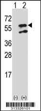 Western blot analysis of his-tag NEIL1 (arrow) using his tag antibody. 293 cell lysates (2 ug/lane) either nontransfected (Lane 1) or transiently transfected with the gene