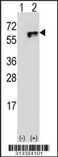Western blot analysis of his-tag ESAM (arrow) using his tag antibody. 293 cell lysates (2 ug/lane) either nontransfected (Lane 1) or transiently transfected with the gene