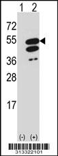 Western blot analysis of his-tag CBX8 (arrow) using his tag antibody. 293 cell lysates (2 ug/lane) either nontransfected (Lane 1) or transiently transfected with the gene