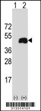 Western blot analysis of his-tag NDRG2 (arrow) using his tag antibody. 293 cell lysates (2 ug/lane) either nontransfected (Lane 1) or transiently transfected with the gene