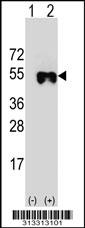 Western blot analysis of his-tag CDC42EP4 (arrow) using his tag antibody. 293 cell lysates (2 ug/lane) either nontransfected (Lane 1) or transiently transfected with the gene