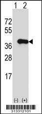Western blot analysis of his-tag DHRS7 (arrow) using his tag antibody. 293 cell lysates (2 ug/lane) either nontransfected (Lane 1) or transiently transfected with the gene