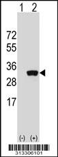 Western blot analysis of his-tag RGS2 (arrow) using his tag antibody. 293 cell lysates (2 ug/lane) either nontransfected (Lane 1) or transiently transfected with the gene