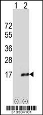 Western blot analysis of his-tag TYROBP (arrow) using his tag antibody. 293 cell lysates (2 ug/lane) either nontransfected (Lane 1) or transiently transfected with the gene