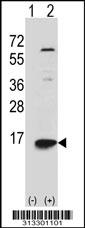 Western blot analysis of his-tag LSM6 (arrow) using his tag antibody. 293 cell lysates (2 ug/lane) either nontransfected (Lane 1) or transiently transfected with the gene