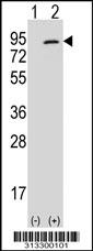 Western blot analysis of his-tag PARN (arrow) using his tag antibody. 293 cell lysates (2 ug/lane) either nontransfected (Lane 1) or transiently transfected with the gene