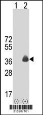 Western blot analysis of his-tag FAIM2 (arrow) using his tag antibody. 293T cell lysates (2 ug/lane) either nontransfected (Lane 1) or transiently transfected with the FAIM2 gene‘
