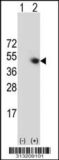 Western blot analysis of his-tag RPP38 (arrow) using his tag antibody. 293 cell lysates (2 ug/lane) either nontransfected (Lane 1) or transiently transfected with the RPP38 gene