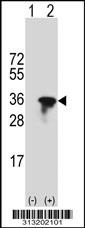 Western blot analysis of his-tag KCNRG (arrow) using his tag antibody. 293 cell lysates (2 ug/lane) either nontransfected (Lane 1) or transiently transfected with the KCNRG gene