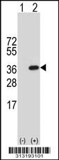 Western blot analysis of his-tag ELA3A (arrow) using his tag antibody. 293 cell lysates (2 ug/lane) either nontransfected (Lane 1) or transiently transfected with the ELA3A gene