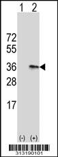 Western blot analysis of his-tag MYOZ2 (arrow) using his tag antibody. 293 cell lysates (2 ug/lane) either nontransfected (Lane 1) or transiently transfected with the MYOZ2 gene