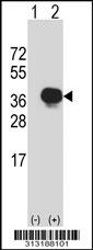 Western blot analysis of his-tag FRMD6 (arrow) using his tag antibody. 293 cell lysates (2 ug/lane) either nontransfected (Lane 1) or transiently transfected with the FRMD6 gene